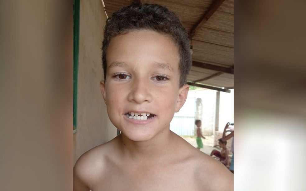Menino de Vianópolis pede ajuda ao Papai Noel para consertar os dentes (Foto: redes sociais)